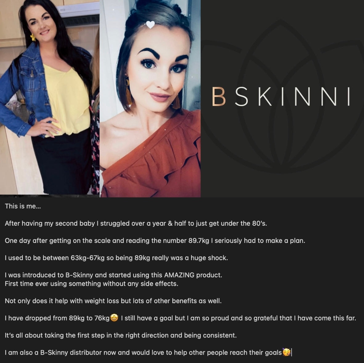 BSkinni